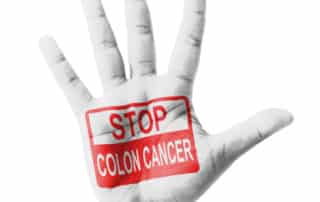 stop colon cancer plano tx